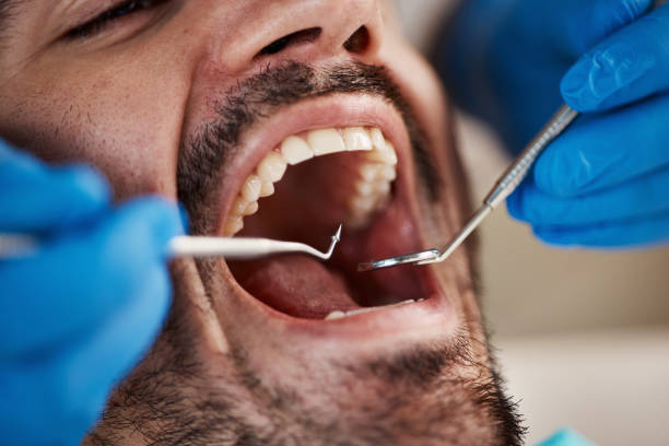 Best Emergency Dentist for Knocked-Out Tooth in Hampton, VA